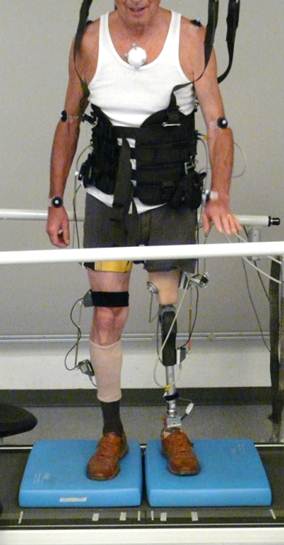 Enlarged view: Fig1. Experimental Prosthesis Prototype